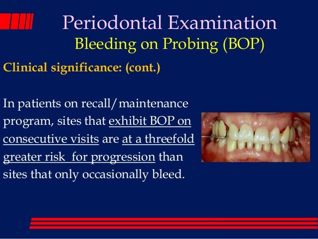 gingivitis gingival bleeding index slideshare